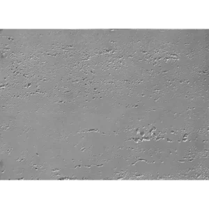 ΕΠΕΝΔΥΣΕΙΣ ΤΟΙΧΟΥ